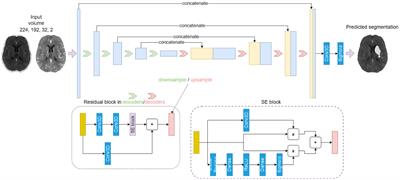 Prediction of tissue outcome in acute ischemic stroke based on single-phase CT angiography at admission